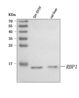 Anti-RBP1 Antibody Picoband® Boster Bio