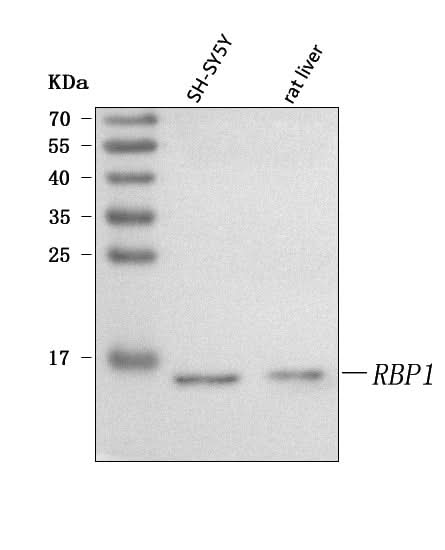 Anti-RBP1 Antibody Picoband® Boster Bio