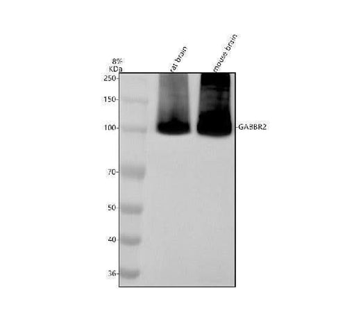 Anti-GABBR2 Antibody Picoband® Boster Bio