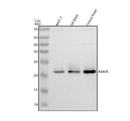 Anti-RAB35 Antibody Picoband® Boster Bio