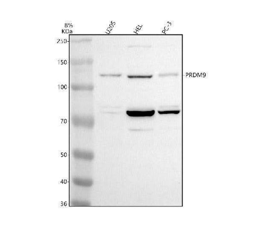 Anti-PRDM9 Antibody Picoband® Boster Bio
