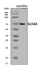 Anti-SLC5A8 Antibody Picoband® Boster Bio