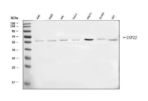 Anti-USP22 Antibody Picoband® Boster Bio
