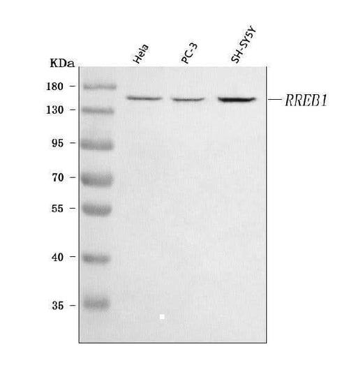 Anti-RREB1 Antibody Picoband® Boster Bio