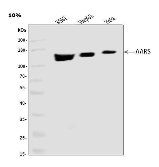 Anti-AlaRS/AARS1 Antibody Picoband® Boster Bio