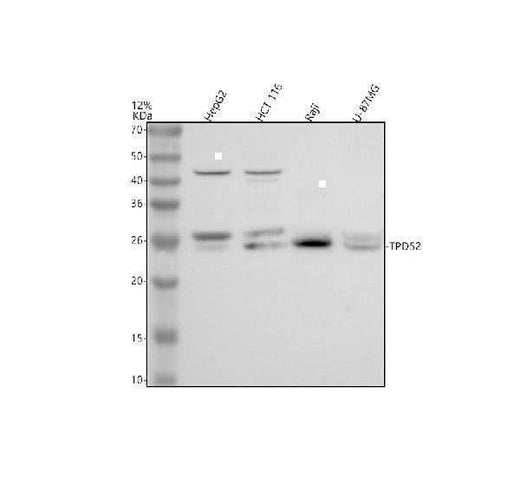 Anti-TPD52 Antibody Picoband® Boster Bio