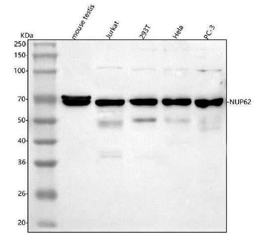 Anti-NUP62 Antibody Picoband® Boster Bio