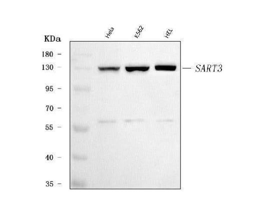 Anti-SART3 Antibody Picoband® Boster Bio