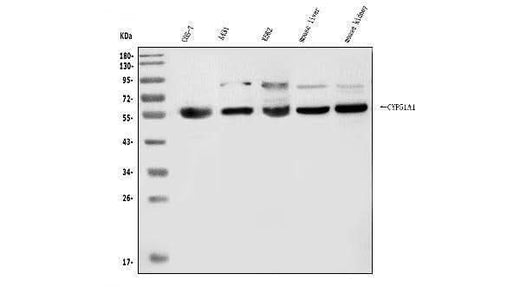 Anti-CYP51A1/CYP51 Antibody Picoband® Boster Bio