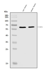 Anti-ZIC3 Antibody Picoband® Boster Bio