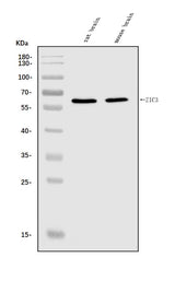 Anti-ZIC3 Antibody Picoband® Boster Bio