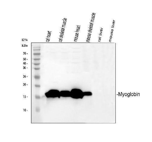Anti-Myoglobin/MB Antibody Picoband® Boster Bio