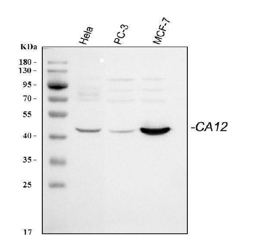 Anti-CA12 Antibody Picoband® Boster Bio