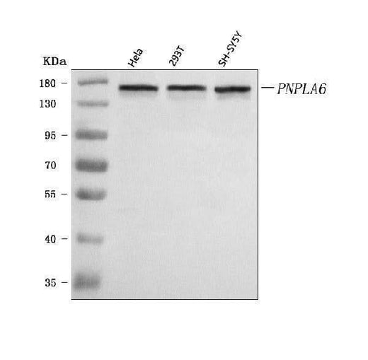 Anti-PNPLA6 Antibody Picoband® Boster Bio