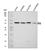 Anti-FRK Antibody Picoband® Boster Bio