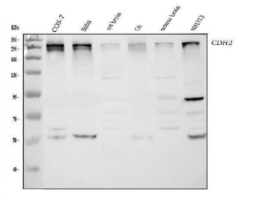 Anti-CHD2 Antibody Picoband® Boster Bio