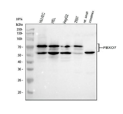 Anti-FBXO7 Antibody Picoband® Boster Bio