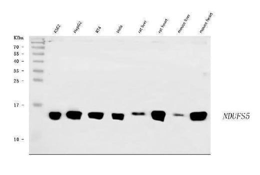Anti-NDUFS5 Antibody Picoband® Boster Bio