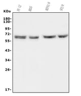 Anti-HYAL1 Antibody Picoband® Boster Bio