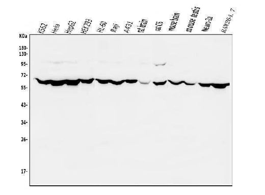 Anti-PIAS2 Antibody Picoband® Boster Bio