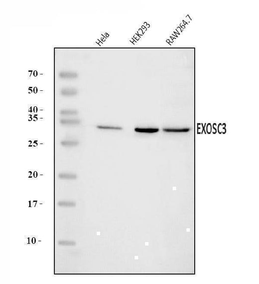 Anti-EXOSC3 Antibody Picoband® Boster Bio