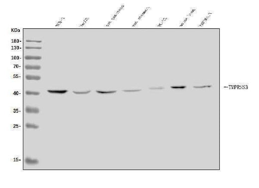 Anti-TMPRSS3 Antibody Picoband® Boster Bio