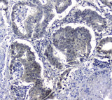 Anti-Hsp105/HSPH1 Antibody Picoband® Boster Bio