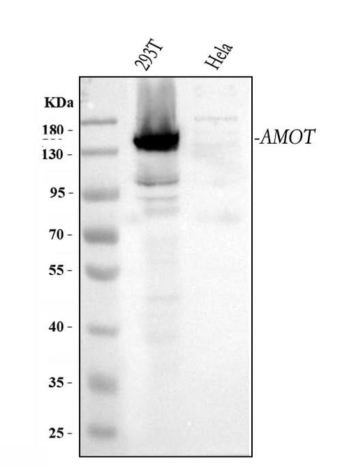 Anti-Angiomotin/AMOT Antibody Picoband® Boster Bio