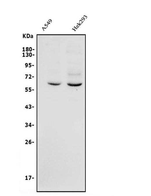 Anti-GRB14 Antibody Picoband® Boster Bio