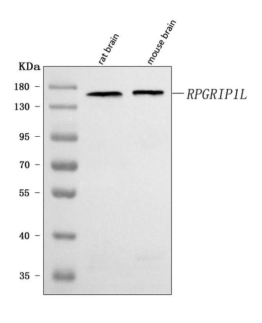 Anti-RPGRIP1L Antibody Picoband® Boster Bio