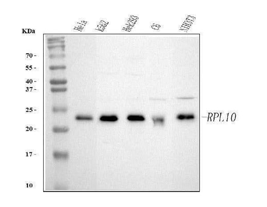 Anti-RPL10 Antibody Picoband® Boster Bio