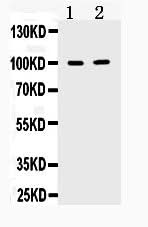 Anti-TACC1 Antibody Picoband® Boster Bio