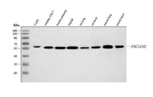 Anti-PACSIN2 Antibody Picoband® Boster Bio