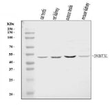 Anti-DNMT3L Antibody Picoband® Boster Bio