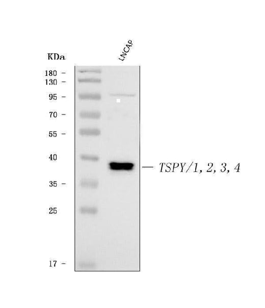 Anti-TSPY1/2/3/4 Antibody Picoband® Boster Bio
