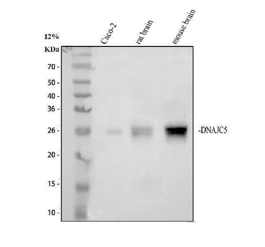 Anti-DNAJC5 Antibody Picoband® Boster Bio