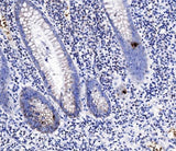 Anti-Peptide YY/PYY Antibody Boster Bio