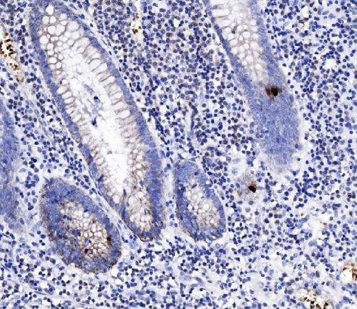 Anti-Peptide YY/PYY Antibody Boster Bio