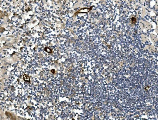 Anti-MAdCAM1 Antibody Boster Bio