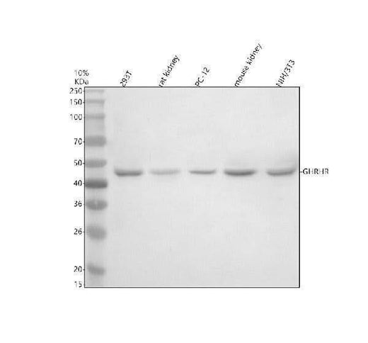 Anti-GHRHR Antibody Picoband® Boster Bio
