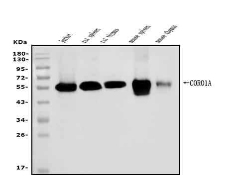 Anti-Coronin 1a/TACO/CORO1A Antibody Picoband® Boster Bio