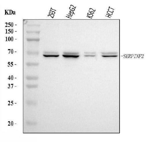 Anti-Alpha 2 Antiplasmin/SERPINF2 Antibody Picoband® Boster Bio