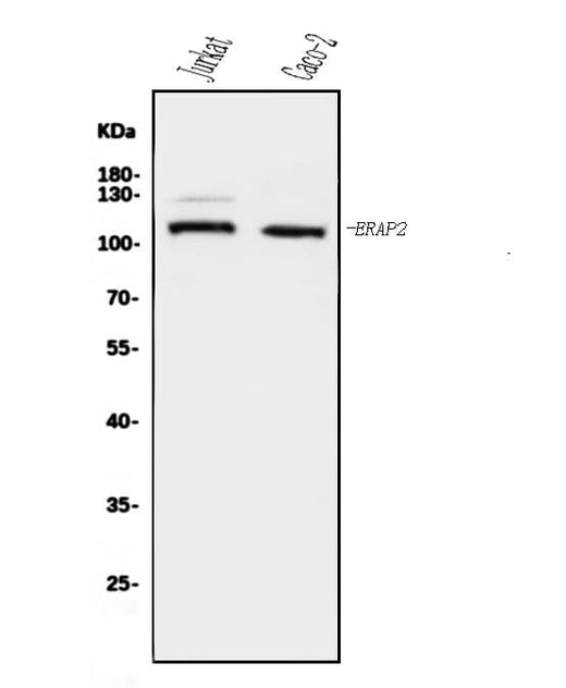 Anti-ERAP2 Antibody Picoband® Boster Bio