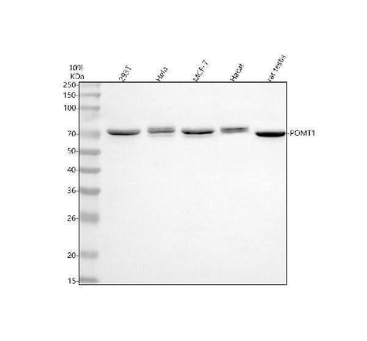Anti-POMT1 Antibody Picoband® Boster Bio