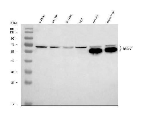 Anti-RGS7 Antibody Picoband® Boster Bio