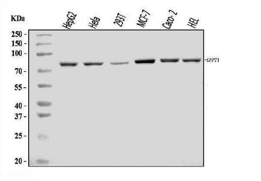 Anti-GFPT1 Antibody Picoband® Boster Bio