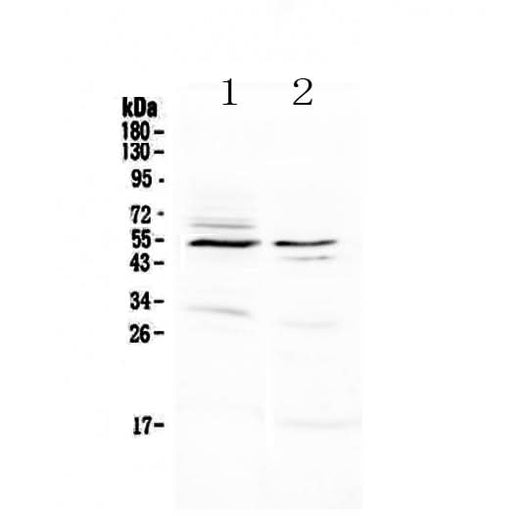 Anti-VIP Receptor 1/VIPR1 Antibody Picoband® Boster Bio