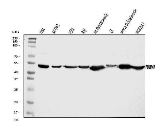 Anti-PDLIM7 Antibody Picoband® Boster Bio