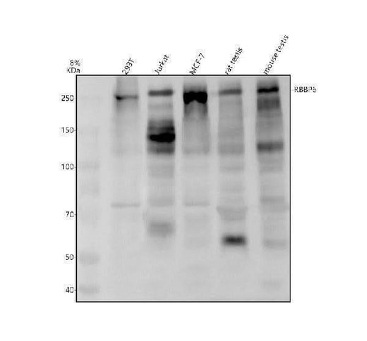 Anti-RBBP6 Antibody Picoband® Boster Bio