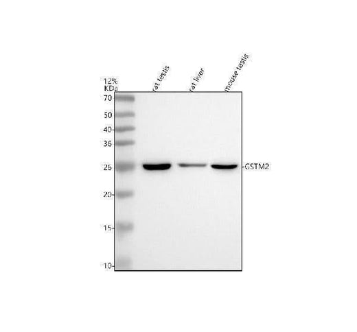 Anti-GSTM2 Antibody Picoband® Boster Bio